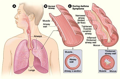 airway-walls